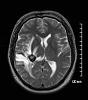 Click image for larger version. 

Name:	BrainMRI.jpg 
Views:	41 
Size:	6.7 KB 
ID:	39419