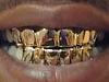 Click image for larger version. 

Name:	grillz.jpe 
Views:	60 
Size:	2.6 KB 
ID:	62934